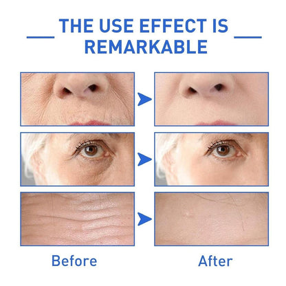 Botox Anti-Aging Serum(Pack of 2)